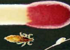 enlarged version of a head louse and egg, in comparison to a match stick